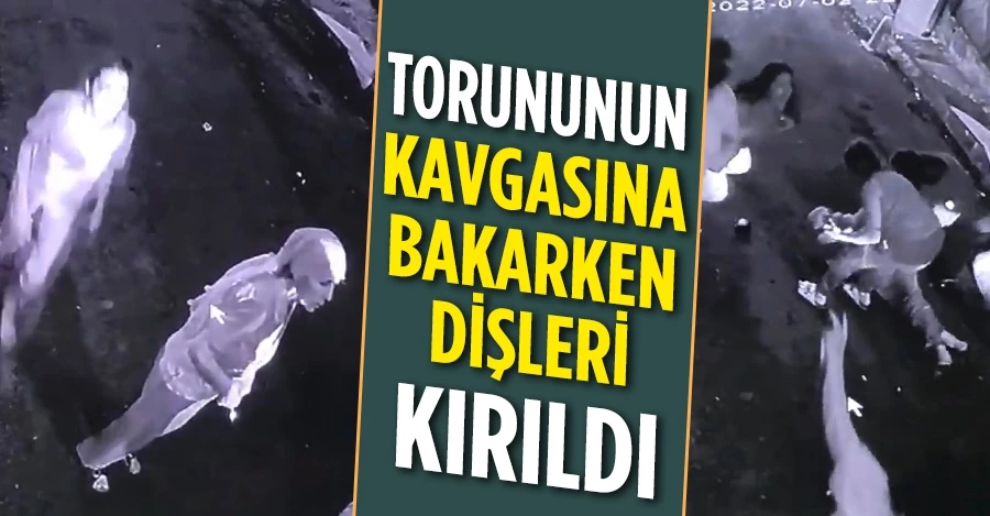 İstanbul’da feci olay kamerada: Torununun kavgasına bakarken dişleri kırıldı 