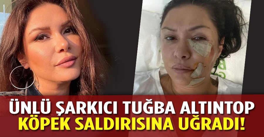 Ünlü şarkıcı Tuğba Altıntop köpek saldırısına uğradı   