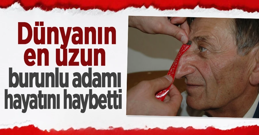  Dünyanın en uzun burunlu adamı hayatını kaybetti 