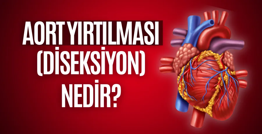 Aort damarı yırtılması (diseksiyonu) nedir?